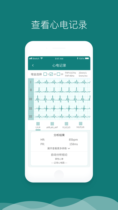 及時心電iphone版