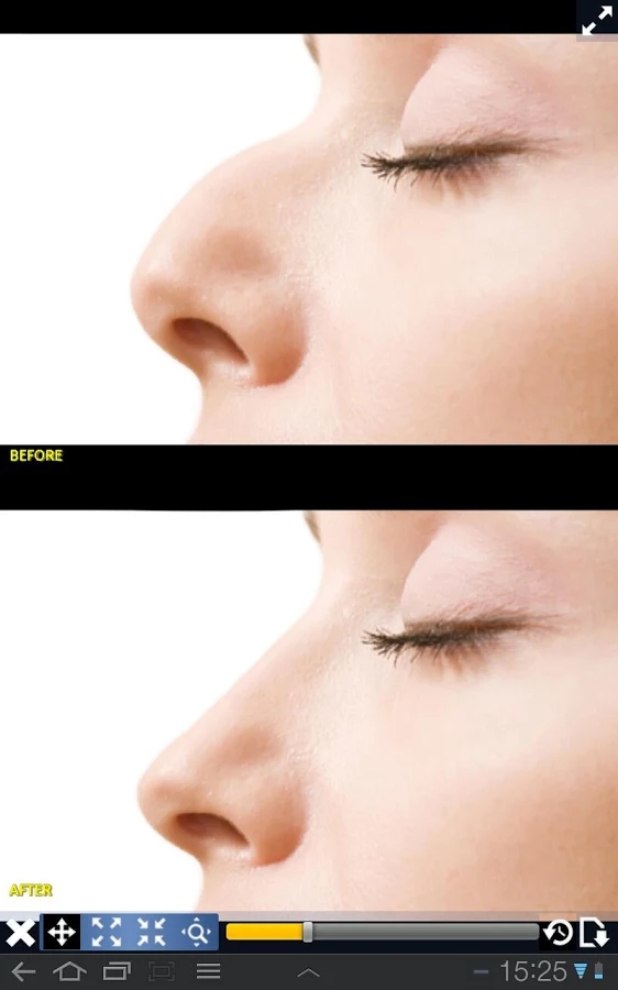 整容模擬器軟件(Plastic Surgery Simulator lite)